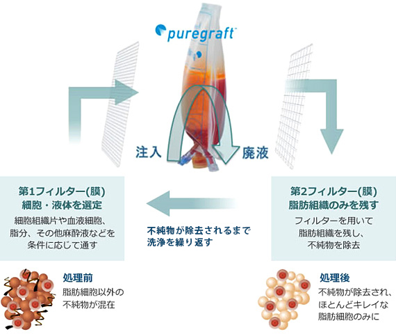 ピュアグラフト