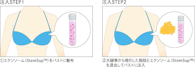 注入STEP