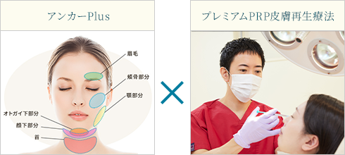 アンカーPlus×プレミアムPRP皮膚再生療法