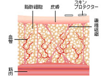 皮膚の保護＆チューメセント