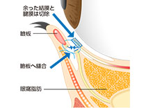 眼球周辺の断面図