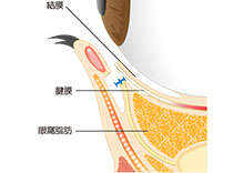 眼球周辺の断面図