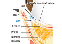 眼球周辺の断面図