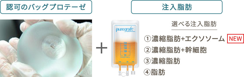 認可のバッグプロテーゼ + 注入脂肪 選べる注入脂肪 1 濃縮脂肪+エクソソーム NEW 2 濃縮脂肪+幹細胞 3 濃縮脂肪 4 脂肪