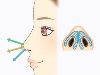 2.鼻先・団子鼻のお悩み