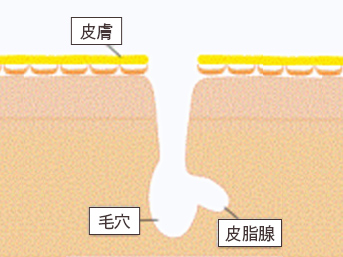 毛穴(開き・黒ずみ)