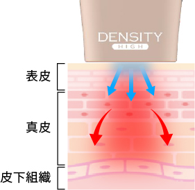 高出力のRF（高周波）エネルギーによる高い効果