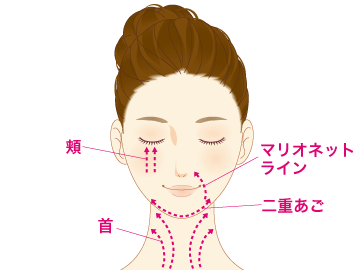 TESSリフト（テスリフト）の適応部位