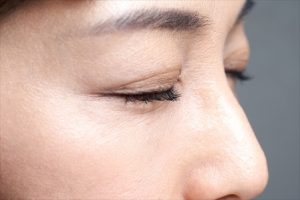 30代や40代での二重整形は遅い?