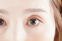 二重整形の種類について