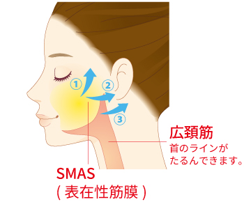 SMAS ダブルフラップ法