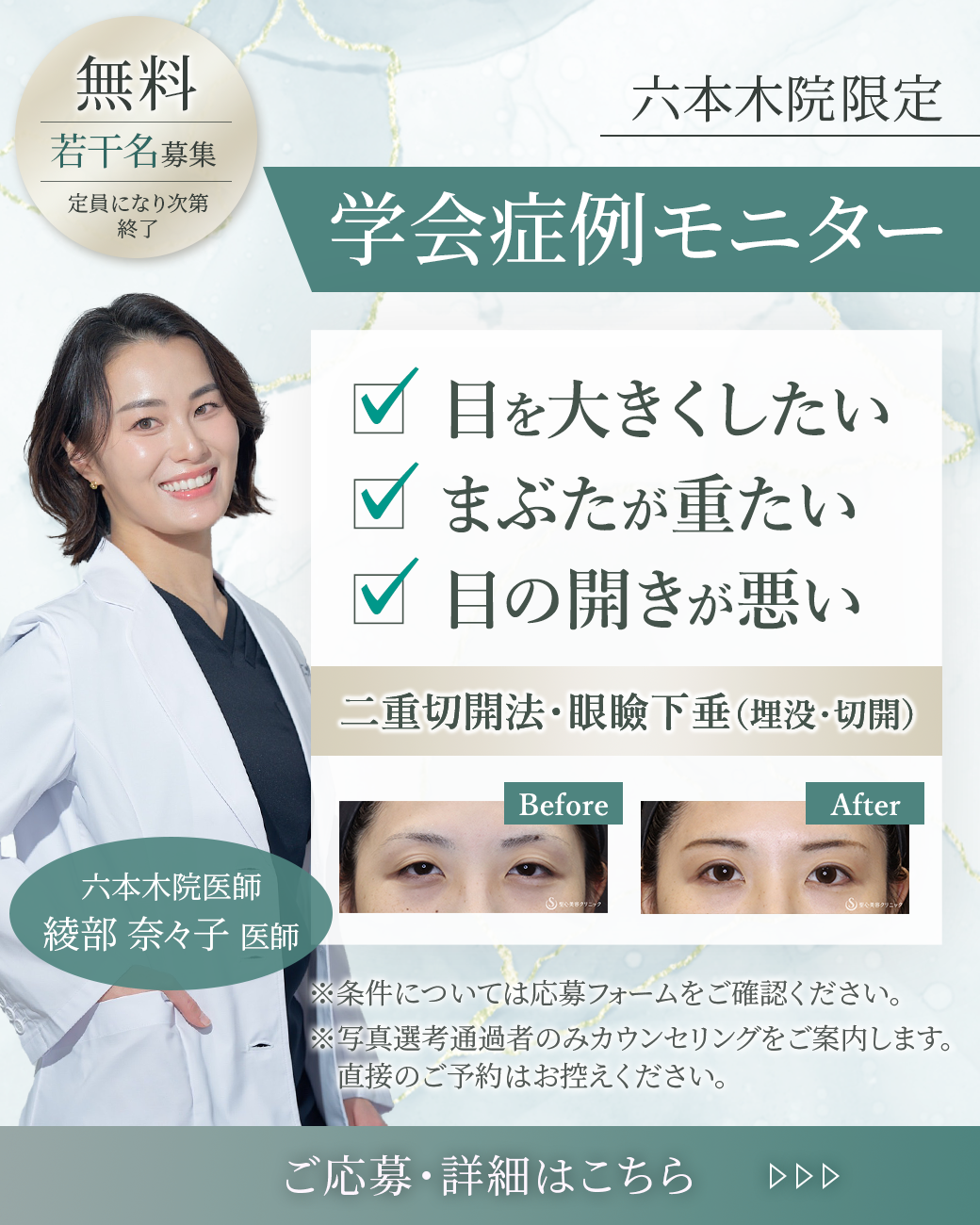 綾部医師モニターを募集