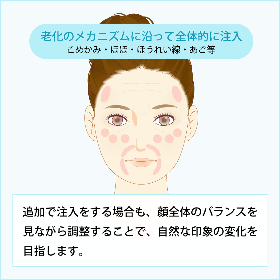 従来の注入方法との違い
