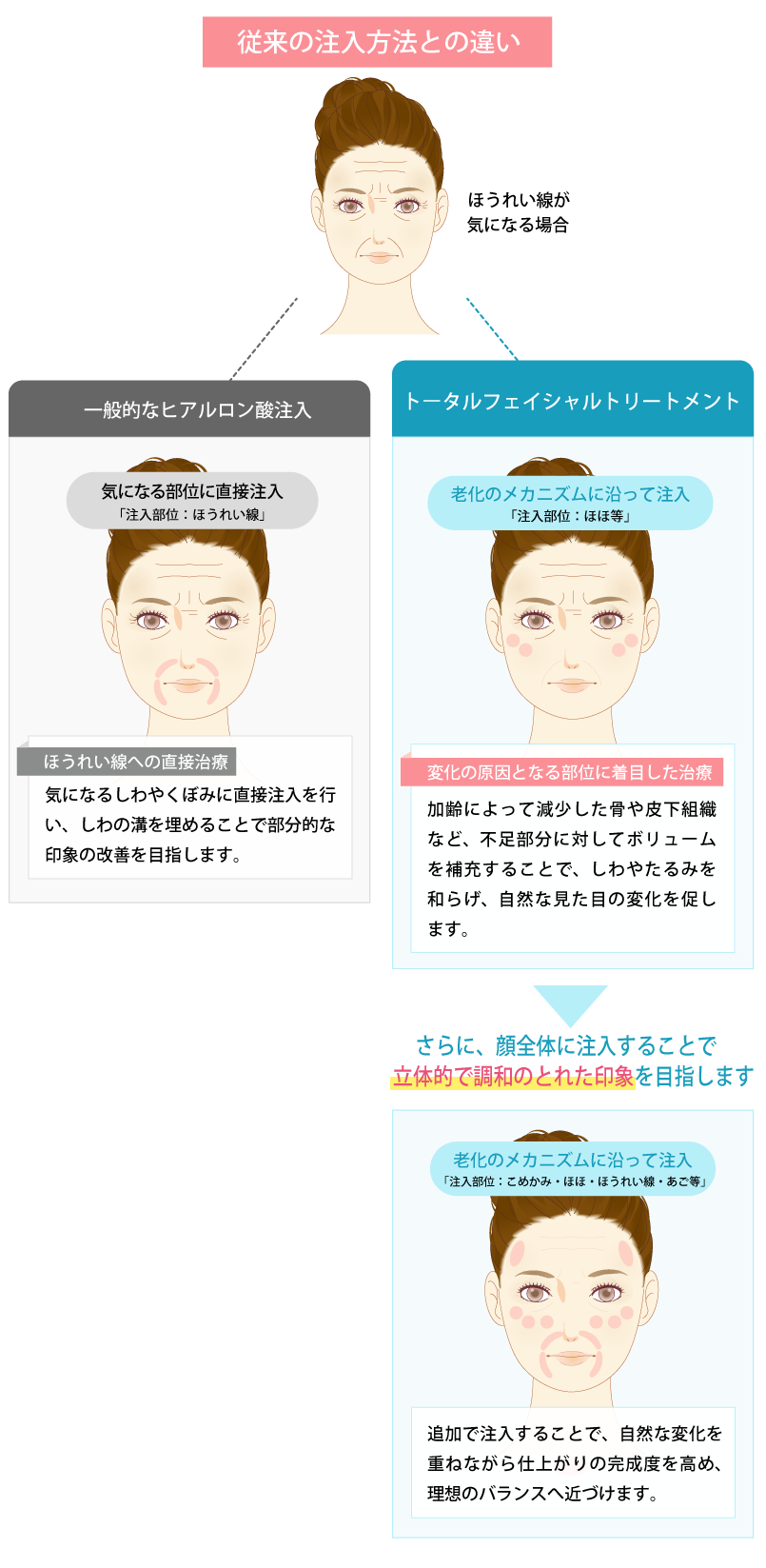 従来の注入方法との違い