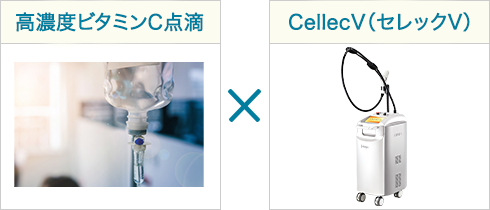 高濃度ビタミンC点滴×CellecV（セレックV）