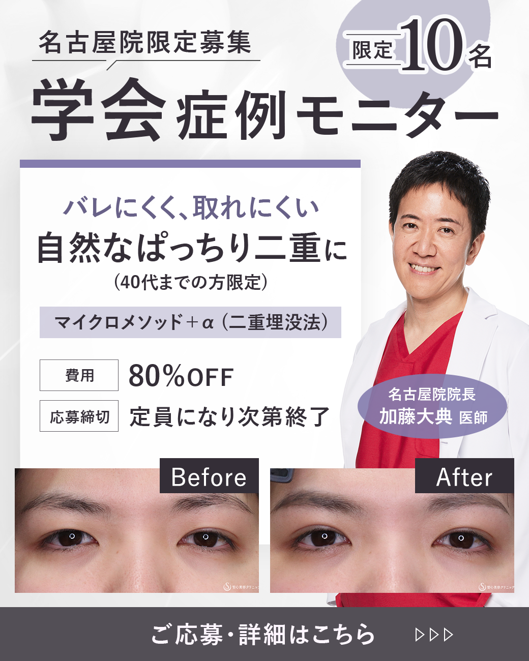 加藤院長モニターを募集