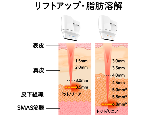 脂肪減少とタイトニングの相乗効果イラスト