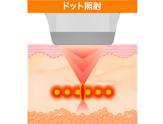 照射イラスト