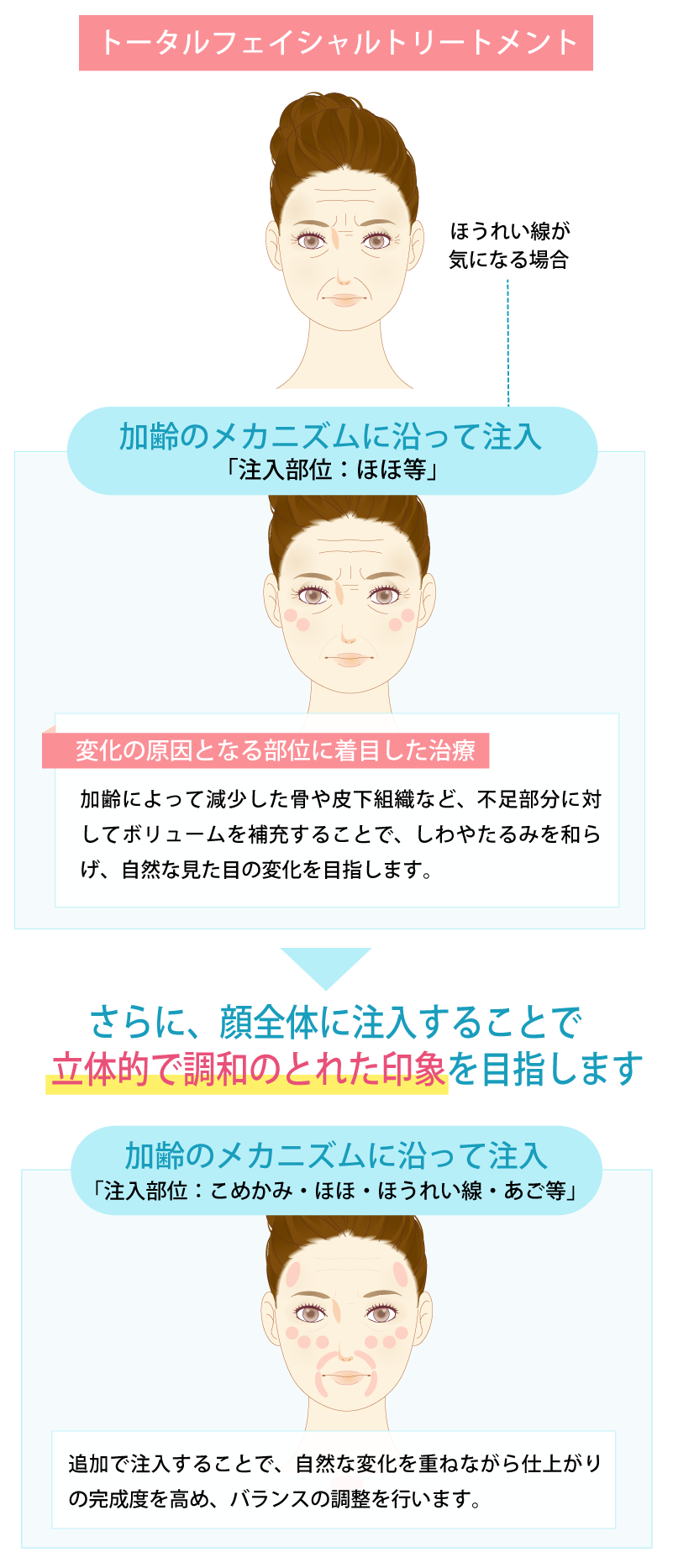 従来の注入方法との違い