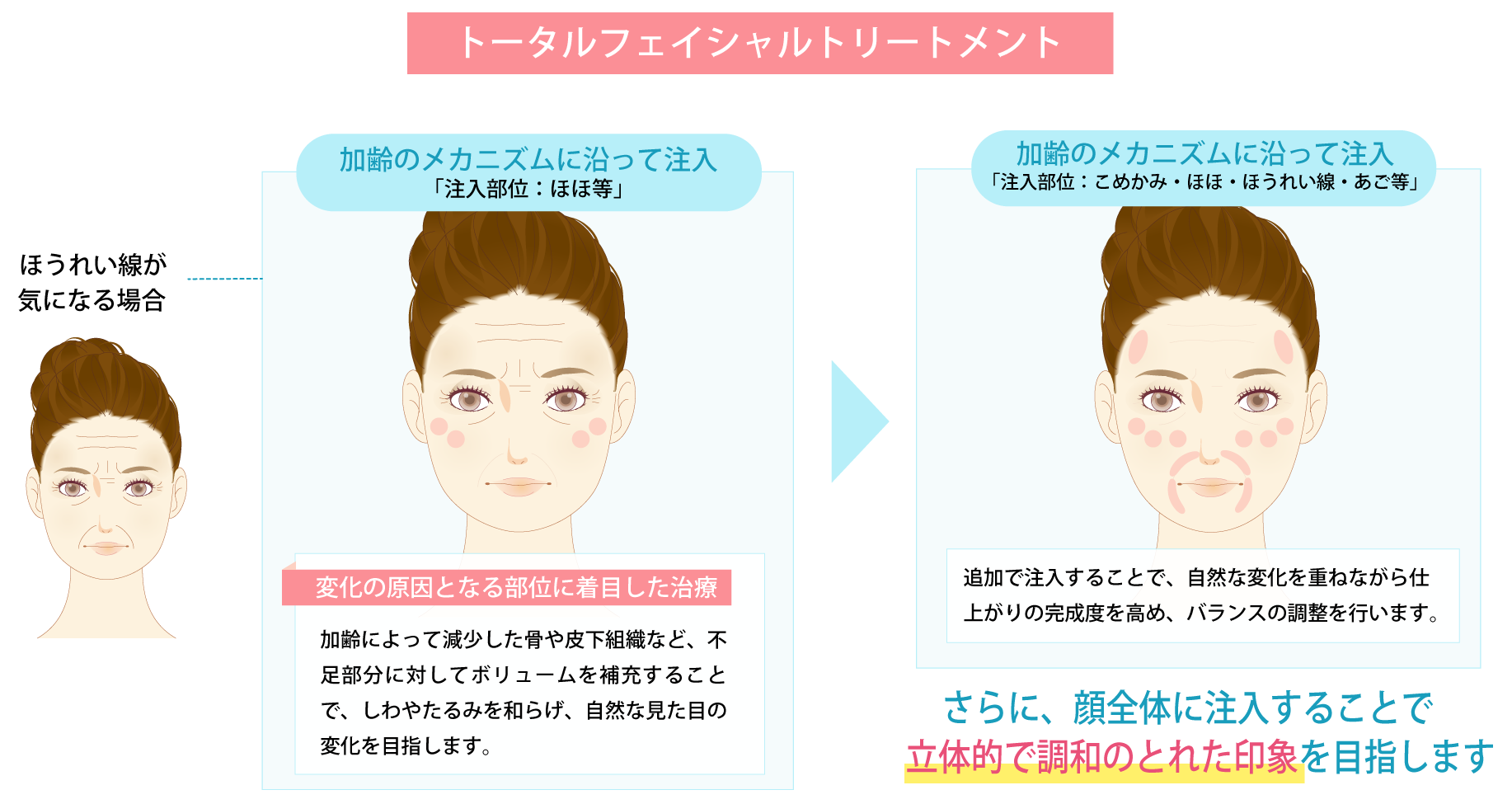 従来の注入方法との違い