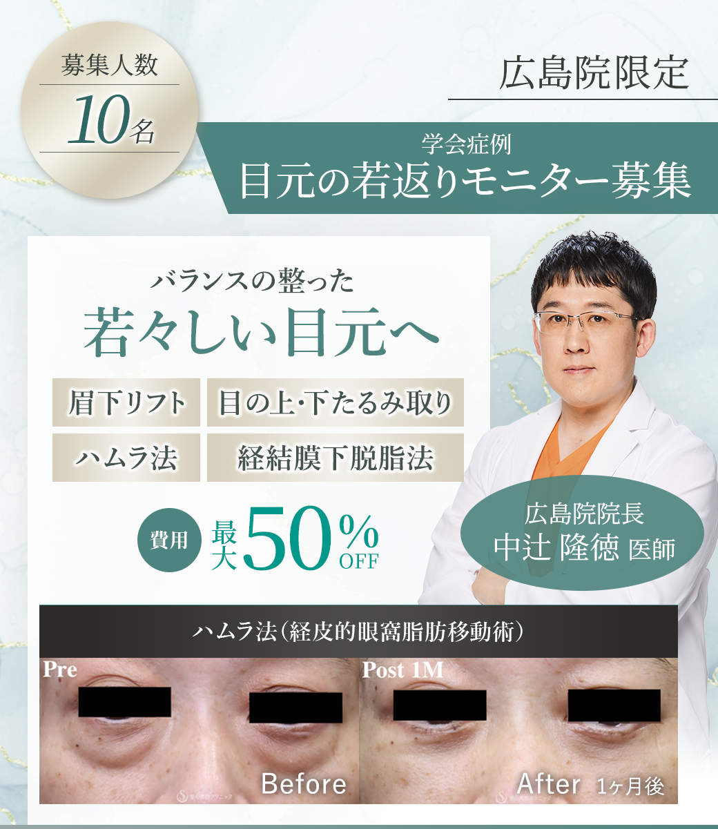 中辻院長モニターを募集