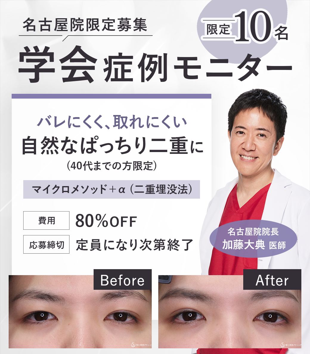 加藤院長モニターを募集