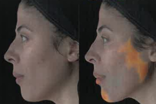 治療のBefore / Afterを数値で比較