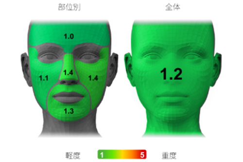 0.1mm単位で計測する高精度な3D解析