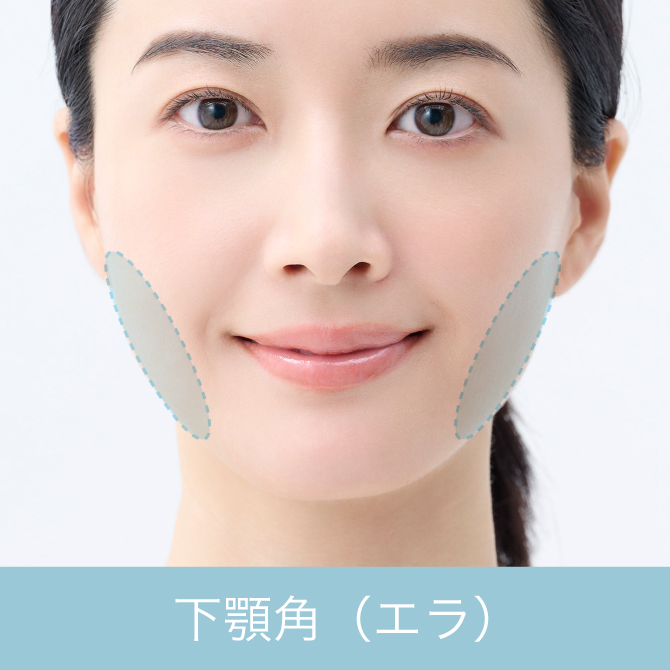 下顎角（エラ）形成