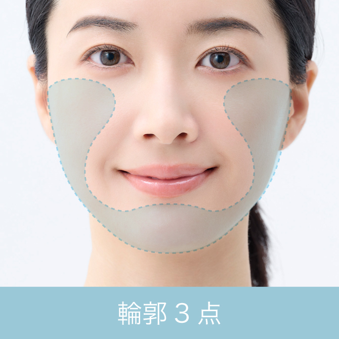 輪郭3点（頬骨骨切り＋Vライン形成）