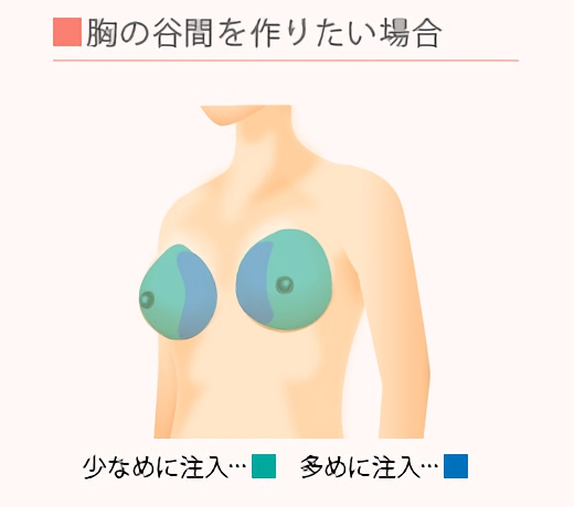 胸の谷間を作りたい場合