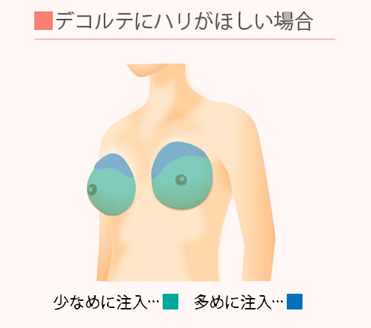 デコルテにハリがほしい場合