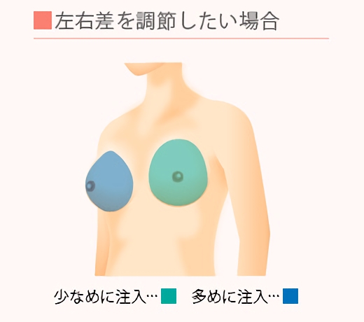 左右差を調節したい場合