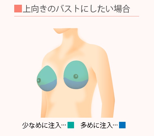 上向きのバストにしたい場合