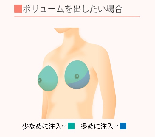 ボリュームを出したい場合