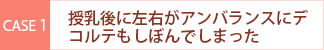 case1 授乳後に左右がアンバランスにデコルテもしぼんでしまった・・・