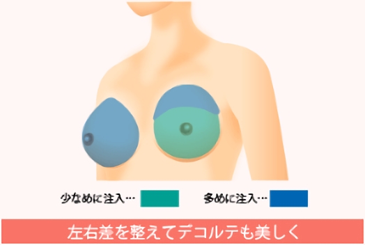 左右差を揃えてデコルテも美しく