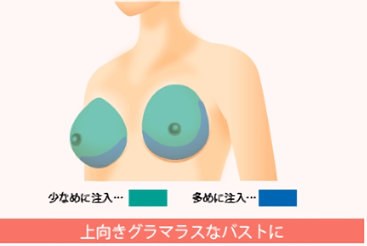 上向きのグラマラスなバストに