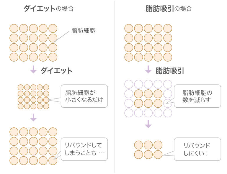 ダイエットの場合：脂肪細胞が小さくなるだけ。リバウンドしてしまうことも…。 脂肪吸引の場合：脂肪細胞の数を減らす