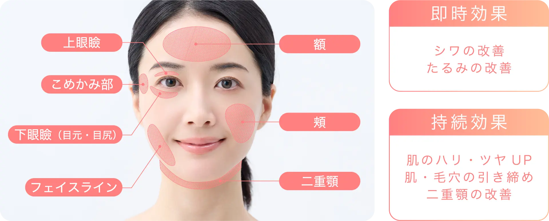 DENSITY（デンシティ）