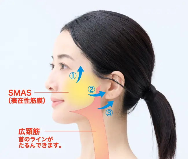SMAS ダブルフラップ法