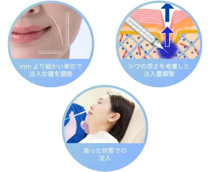 mmよりも細かい単位で注入位置を調整、シワの深さを考慮した注入量調整、座った状態での注入