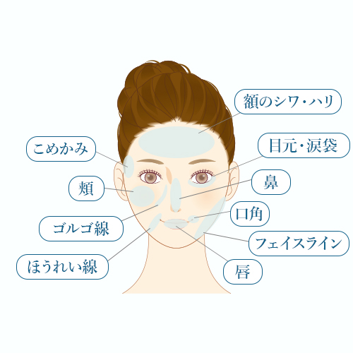 カスタマイズヒアル