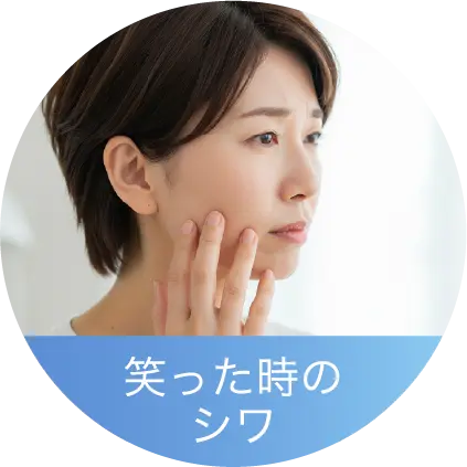 笑った時のシワ
