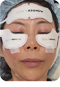 ワンダーフェイスプロ  ※小林院長によるトライアル時の写真