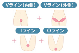 ハイジニーナ（Vライン内側+Vライン外側+Iライン+Oライン）