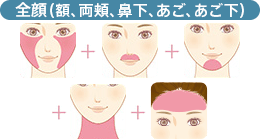 額+両頬+鼻下+あご+あご下（※眉周り、額の生え際は含まず）