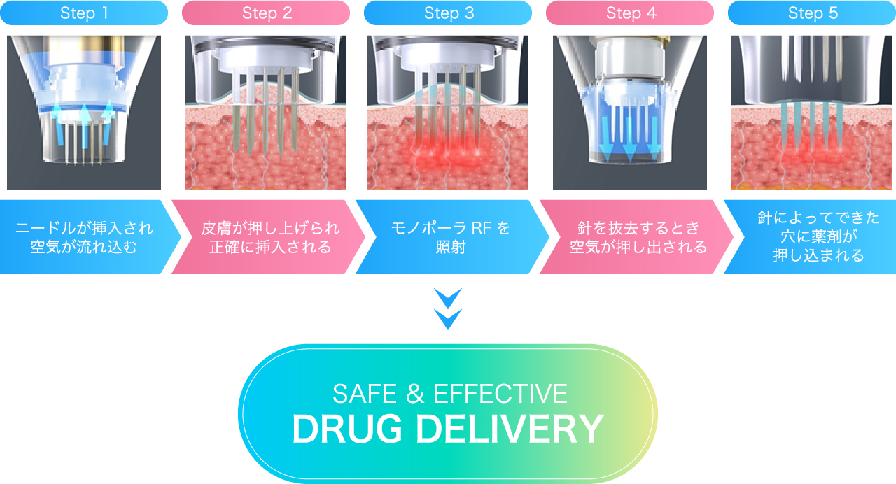 治療メカニズム（瘢痕治療＋しわ・リジュビネーション＋ニキビ）