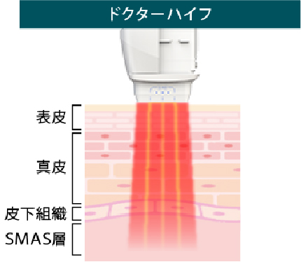 ドクターハイフ