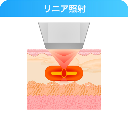 【二重アゴ解消&小顔効果】効果のメカニズム